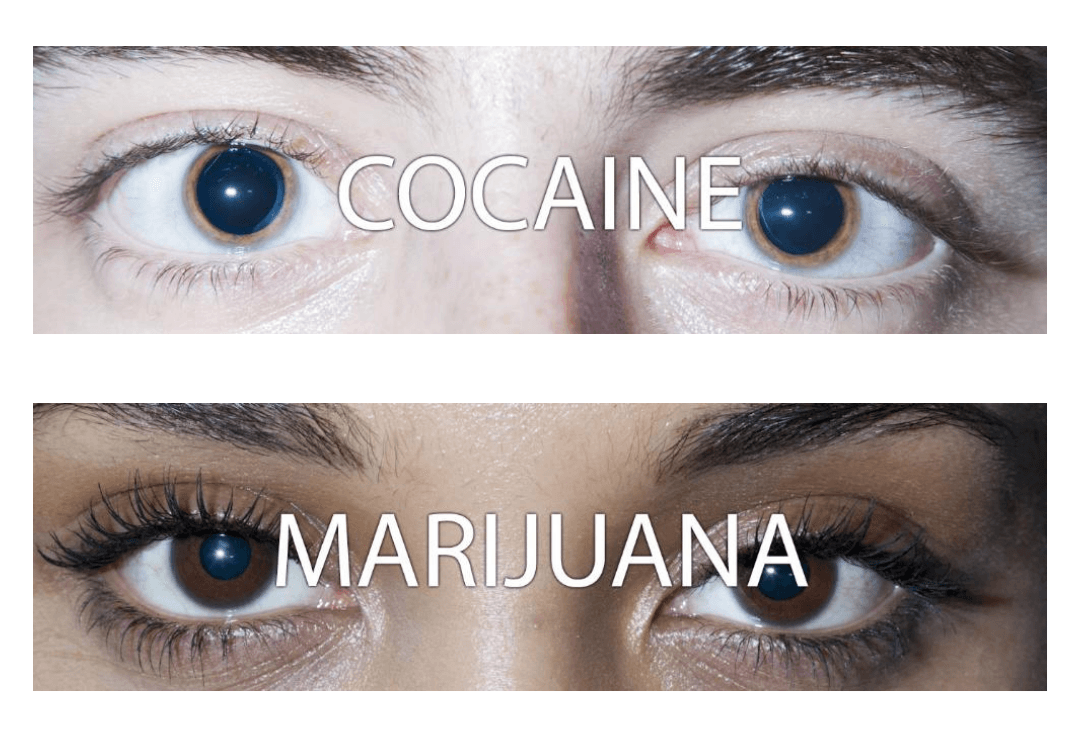 Como ficam os olhos de pessoas sob efeito das drogas