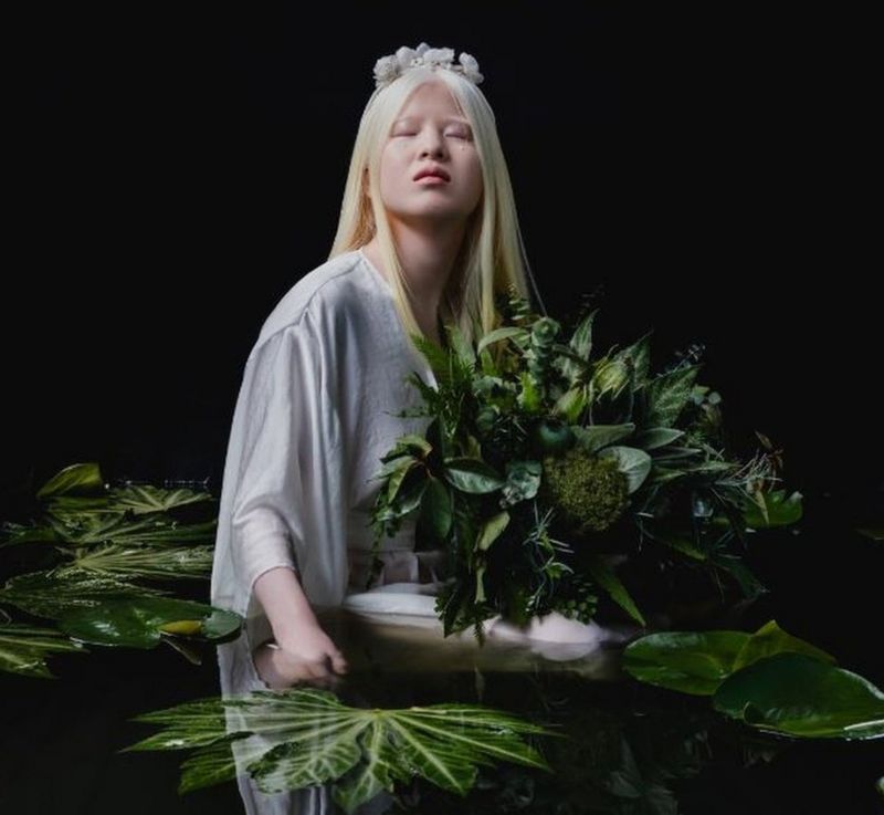 Xueli Abbing a chinesa albina modelo da Vogue que foi abandonada quando bebe 1