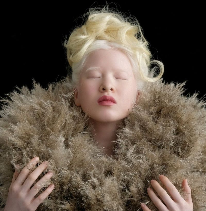 Xueli Abbing a chinesa albina modelo da Vogue que foi abandonada quando bebe 3