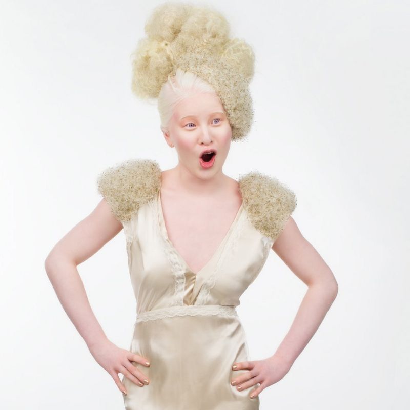 Xueli Abbing a chinesa albina modelo da Vogue que foi abandonada quando bebe 5