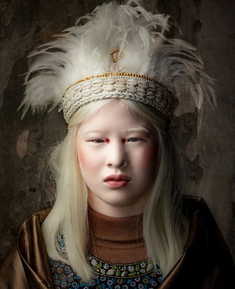 Xueli Abbing a chinesa albina modelo da Vogue que foi abandonada quando bebe 6