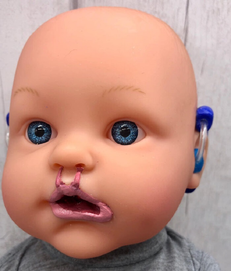 Bright Ears UK organizacao sem fins lucrativos cria bonecas inclusivos para criancas 9